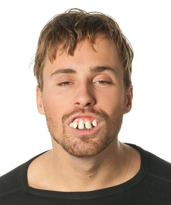 Faux dentier